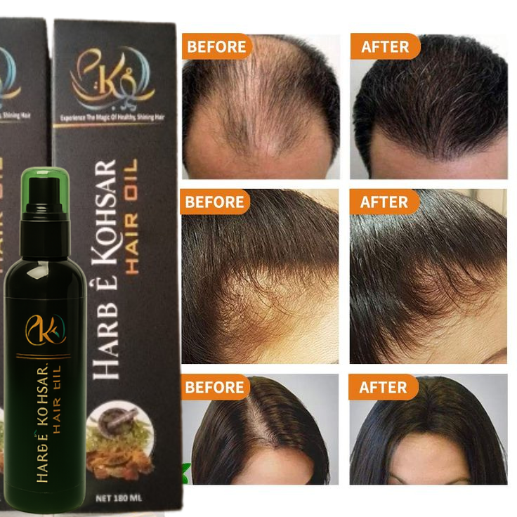 Pakistan #1 Harb E Kohsar hair Oil - comical free 100% Natural ingredients